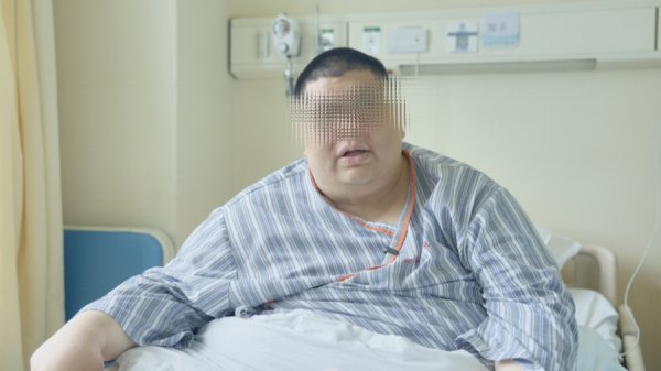 2026世界杯中国官方入口 ​“沪上第一胖”在上海新华病院微创术后半月减重近40斤
